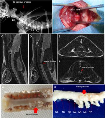 Ultrastructural destruction of neurovascular unit in experimental cervical spondylotic myelopathy